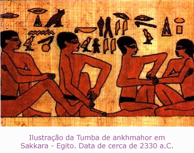 Ilustração da Tumba de ankhmahor em Sakkara - Egito. Data de cerca de 2330 a.C.